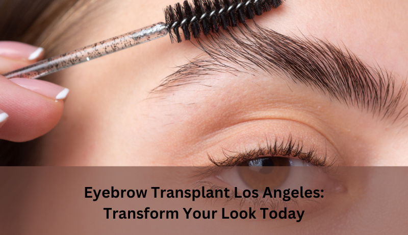 eyebrow transplant Los Angeles